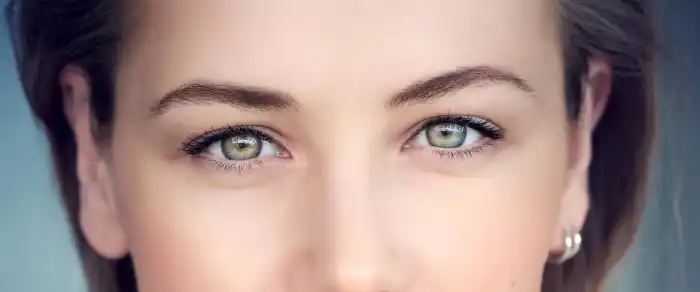 پف بالای پلک دلیل ژنتیکی هم دارد.
