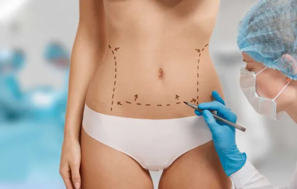 جراحی ابدومینوپلاستی چیست