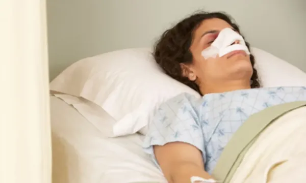 تا چند روز بعد عمل بینی باید سربالا باشد