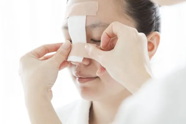 عمل سپتوپلاستی