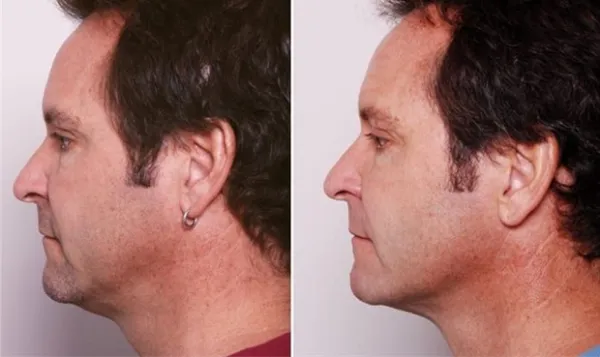 بوکال فت مردان