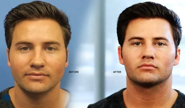 عمل بوکال فت مردان