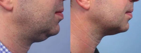 بوکال فت برای مردان