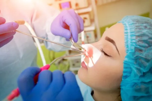 جراحی کوچک کردن شاخک بینی