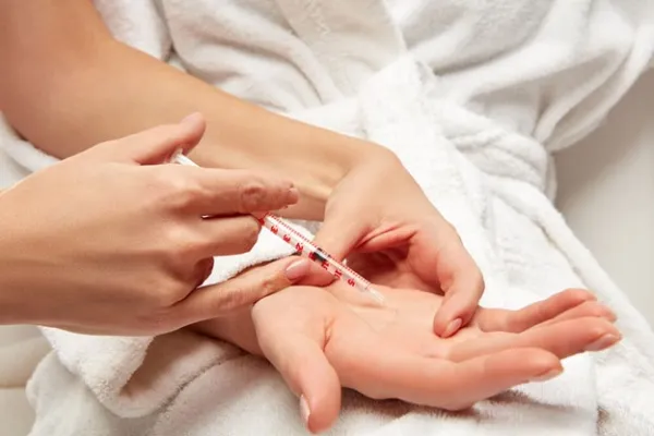 تزریق چربی به پشت دست